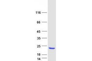 Validation with Western Blot