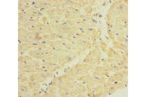 Immunohistochemistry of paraffin-embedded human heart tissue using ABIN7149750 at dilution of 1:100