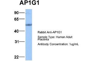 Host: Rabbit Target Name: AP1G1 Sample Type: Human Adult Placenta Antibody Dilution: 1.
