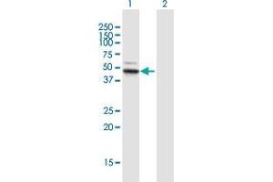 Western Blot analysis of ALDH3B1 expression in transfected 293T cell line by ALDH3B1 MaxPab polyclonal antibody. (ALDH3B1 anticorps  (AA 1-431))