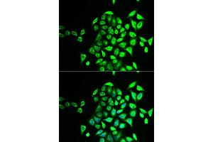 Immunofluorescence analysis of U2OS cells using NAPG antibody (ABIN5973832). (NAPG anticorps)