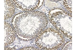 ABIN6257871 and ABIN6273773 at 1/100 staining rat testis tissue by IHC-P.
