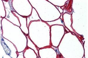 Human Adipocytes: Formalin-Fixed, Paraffin-Embedded (FFPE)