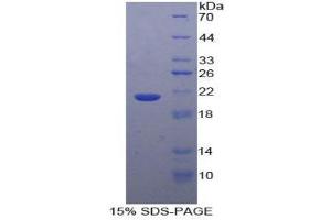 SDS-PAGE (SDS) image for Glucosidase, Alpha, Acid (GAA) (AA 595-770) protein (His tag) (ABIN1079658)