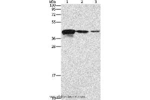 Western blot analysis of Human endometrial carcinoma tissue, A172 and U937 cell, using TWF2 Polyclonal Antibody at dilution of 1:800 (TWF2 anticorps)