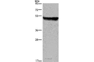 Western blot analysis of Mouse liver tissue, using CYP2E1 Polyclonal Antibody at dilution of 1:250 (CYP2E1 anticorps)