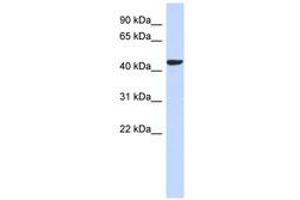 Image no. 1 for anti-Sphingomyelin Synthase 2 (SGMS2) (AA 71-120) antibody (ABIN6741220) (Sphingomyelin Synthase 2 anticorps  (AA 71-120))