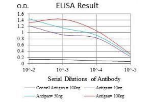 Black line: Control Antigen (100 ng), Purple line: Antigen(10 ng), Blue line: Antigen (50 ng), Red line: Antigen (100 ng), (Glucose-6-Phosphate Dehydrogenase anticorps)