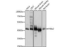 Western blot analysis of extracts of various cell lines, using Pdha2 antibody (ABIN7269770) at 1:1000 dilution. (PDHA2 anticorps  (AA 230-391))