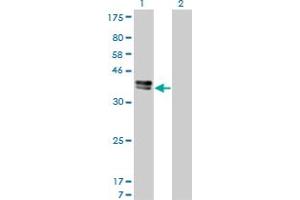 Western Blot analysis of ISL1 expression in transfected 293T cell line by ISL1 monoclonal antibody (M01), clone 1A3.