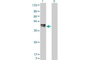 Western Blot analysis of ISL1 expression in transfected 293T cell line by ISL1 monoclonal antibody (M01), clone 1A3. (ISL1 anticorps  (AA 63-159))