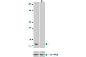 Western blot analysis of ACYP2 over-expressed 293 cell line, cotransfected with ACYP2 Validated Chimera RNAi (Lane 2) or non-transfected control (Lane 1). (Acyp2 anticorps  (AA 1-98))