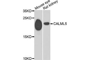 Western blot analysis of extracts of mouse eye and rat kidney, using CALML5 antibody.