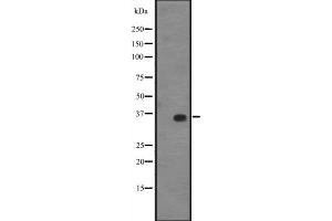 Western blot analysis of KLF14 expression in A431 whole cell lysate ,The lane on the left is treated with the antigen-specific peptide. (KLF14 anticorps  (C-Term))