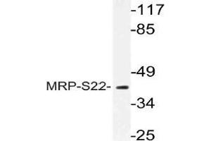 Western blot (WB) analysis of MRP-S22 antibody in extracts from COS cells. (MRPS22 anticorps)