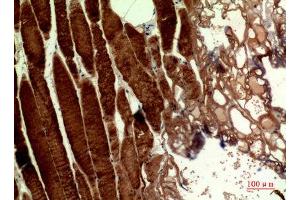 Immunohistochemistry (IHC) analysis of paraffin-embedded Human Muscle, antibody was diluted at 1:100.