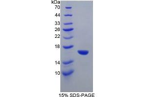 SDS-PAGE of Protein Standard from the Kit (Highly purified E. (GAD Kit ELISA)