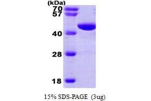 SDS-PAGE (SDS) image for Phosphoglycerate Kinase 1 (PGK1) (AA 1-417) protein (His tag) (ABIN666782)
