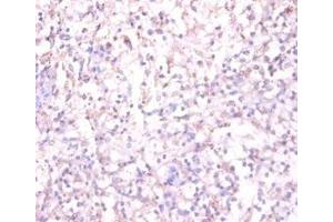 Immunohistochemistry of paraffin-embedded human spleen tissue using ABIN7170878 at dilution of 1:100 (TACR1 anticorps  (AA 1-29))
