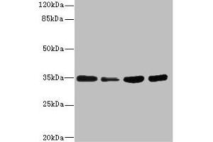 Western blot All lanes: UFD1 antibody at 3. (UFD1L anticorps  (AA 1-307))