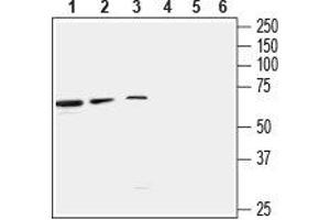 Western blot analysis of rat brain lysate (lanes 1 and 4), mouse brain lysate (lanes 2 and 5) and LNCaP cell line lysate (lanes 3 and 6): - 1-3.