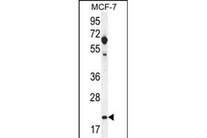 hCG_1646420 Antibody (Center) (ABIN656075 and ABIN2845422) western blot analysis in MCF-7 cell line lysates (35 μg/lane). (CLDN25 anticorps  (AA 99-128))