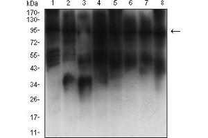 Western blot analysis using KAT2B mouse mAb against C2C12 (1), COS7 (2), HepG2 (3), HCT116 (4), A431 (5), LNCAP (6), NIH/3T3 (7), and F9 (8) cell lysate.