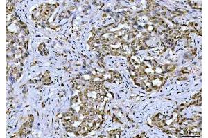 IHC analysis of TIF1 gamma using anti-TIF1 gamma antibody (ABIN3043492).