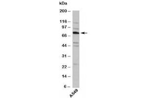 Western blot testing of human samples with TNFAIP2 antibody at 4ug/ml. (TNFAIP2 anticorps  (Internal Region))
