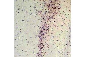 anti-Calcium Binding Protein 2 (CABP2) antibody