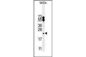 Western blot analysis of FAM96A Antibody (C-term) in WiDr cell line lysates (35ug/lane). (FAM96A anticorps  (C-Term))