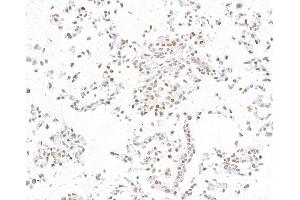 Immunocytochemistry (ICC) image for anti-Runt-Related Transcription Factor 2 (RUNX2) (AA 300-350) antibody (ABIN7795798) (Recombinant RUNX2 anticorps  (AA 300-350))