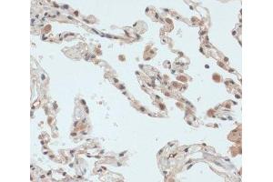 Immunohistochemistry of paraffin-embedded Human lung using TXN Polyclonal Antibody at dilution of 1:100 (40x lens). (TXN anticorps)