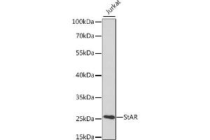 Western blot analysis of extracts of various cell lines, using StAR antibody (ABIN3021302, ABIN3021303, ABIN3021304 and ABIN6214574) at 1:400 dilution. (STAR anticorps  (AA 64-285))