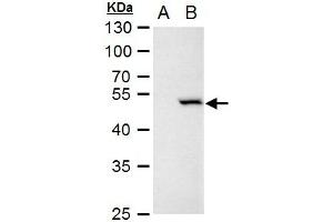 WB Image Chk1 antibody [C1C2-6], Internal detects Chk1 protein by western blot analysis. (CHEK1 anticorps)