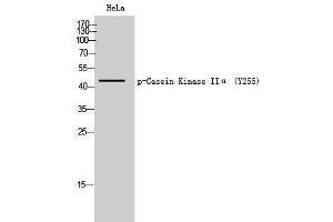 Western Blotting (WB) image for anti-Casein Kinase 2 alpha 1 (CSNK2A1) (pTyr255) antibody (ABIN3173062) (CSNK2A1/CK II alpha anticorps  (pTyr255))