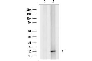 anti-Mitochondrial Ribosomal Protein S16 (MRPS16) (Internal Region) antibody