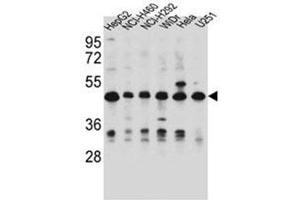 Western blot analysis of DUS1L Antibody (C-term) in HepG2, NCI-H460, NCI-H292, WiDr, Hela, U251 cell line lysates (35ug/lane). (DUS1L anticorps  (C-Term))