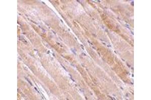 Immunohistochemistry of emerin in human skeletal muscle tissue with emerin antibody at 2. (Emerin anticorps  (N-Term))
