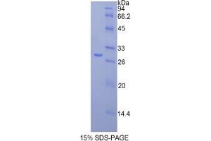 SDS-PAGE analysis of Mouse Fatty Acid Synthase Protein.