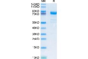 Human CD36/SR-B3 on Tris-Bis PAGE under reduced condition.