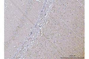 IHC analysis of VPS53 using anti-VPS53 antibody (ABIN7599731). (VPS53 anticorps  (AA 11-699))