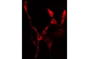 ABIN6276547 staining  Hela cells by IF/ICC. (FTH1 anticorps  (C-Term))