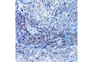 Immunohistochemistry of paraffin-embedded rat spleen using S Rabbit pAb (ABIN6130296, ABIN6147396, ABIN6147398 and ABIN6221485) at dilution of 1:200 (40x lens).