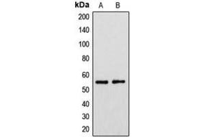 Western blot analysis of Cytochrome P450 39A1 expression in HeLa (A), HuvEc (B) whole cell lysates.