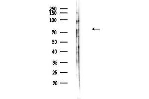 anti-phosphodiesterase 1C, Calmodulin-Dependent 70kDa (PDE1C) (Internal Region) antibody