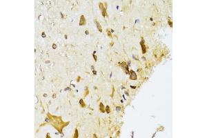 Immunohistochemistry of paraffin-embedded rat spinal cord using RPL13 Antibody (ABIN2559760) at dilution of 1:100 (40x lens). (RPL13 anticorps)