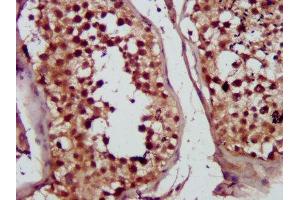 IHC image of ABIN7149997 diluted at 1:300 and staining in paraffin-embedded human testis tissue performed on a Leica BondTM system.