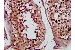 IHC image of ABIN7149997 diluted at 1:300 and staining in paraffin-embedded human testis tissue performed on a Leica BondTM system. (MVD anticorps  (AA 69-221))