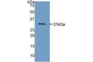 Western blot analysis of recombinant Human COL4a1. (COL4A1 anticorps  (AA 1444-1669))